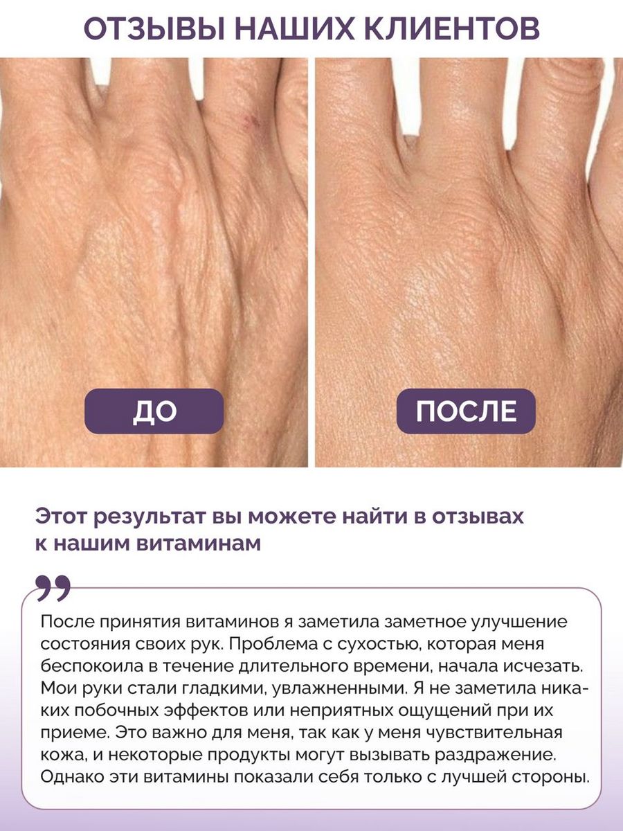 Витамины для волос кожи ногтей BIOTTE hair nails skin витаминно-минеральный комплекс БАД 180 капсул - фото 5