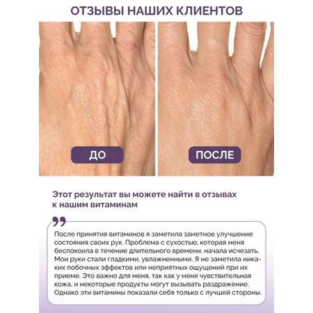 Витамины для волос кожи ногтей BIOTTE hair nails skin витаминно-минеральный комплекс БАД 180 капсул