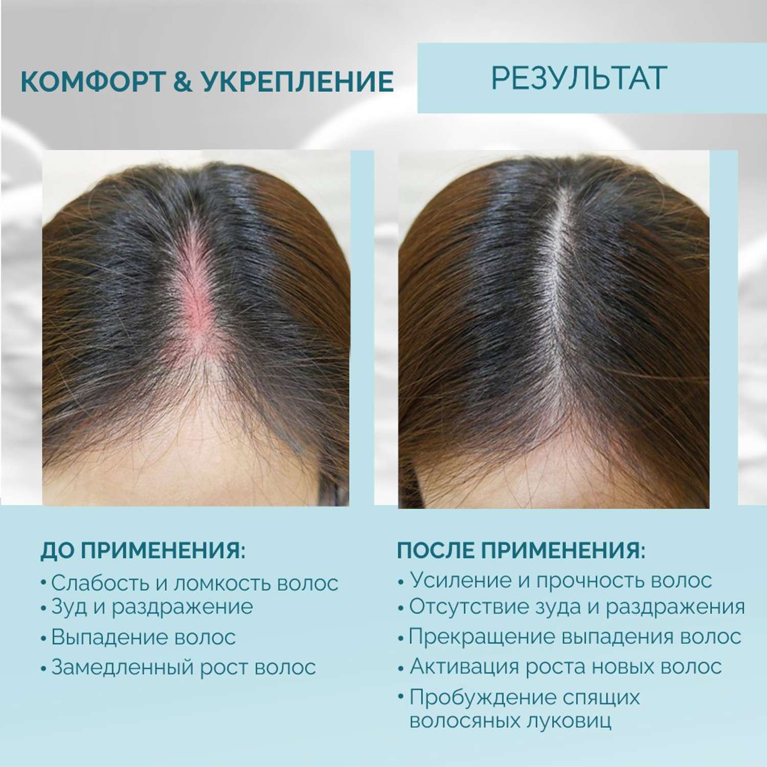Лосьон Rinfoltil PRO Спрей для волос от выпадения для чувствительной кожи головы 100 мл - фото 3