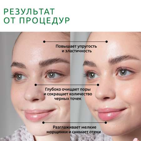 Прибор ReadySkin Nova для ультразвуковой чистки лица