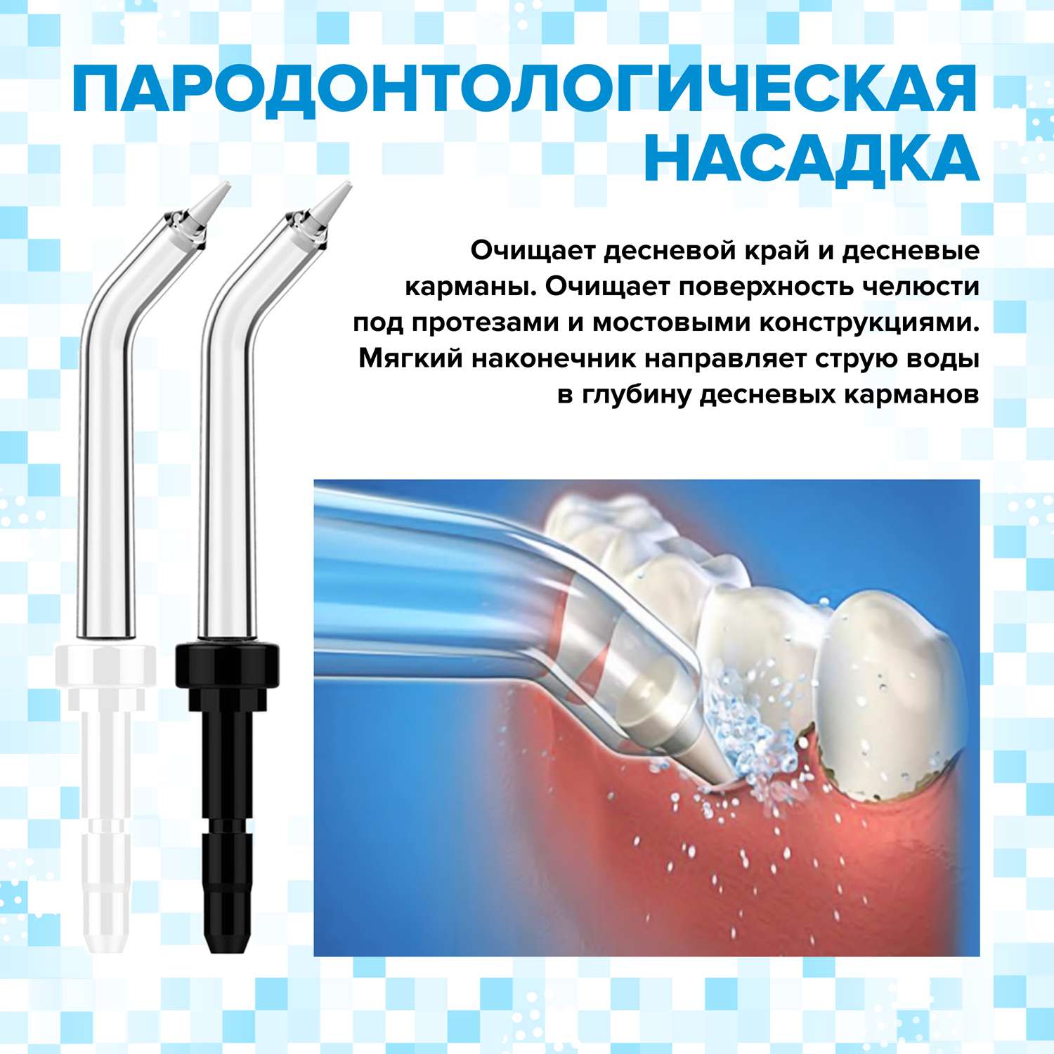 Как пользоваться насадками для ирригатора. Пародонтологические насадки ирригатор. Пародонтологическая насадка для ирригатора. Насадка зубная щётка для ирригатора PECHAM. Насадка для карманов зубов ирригатор.