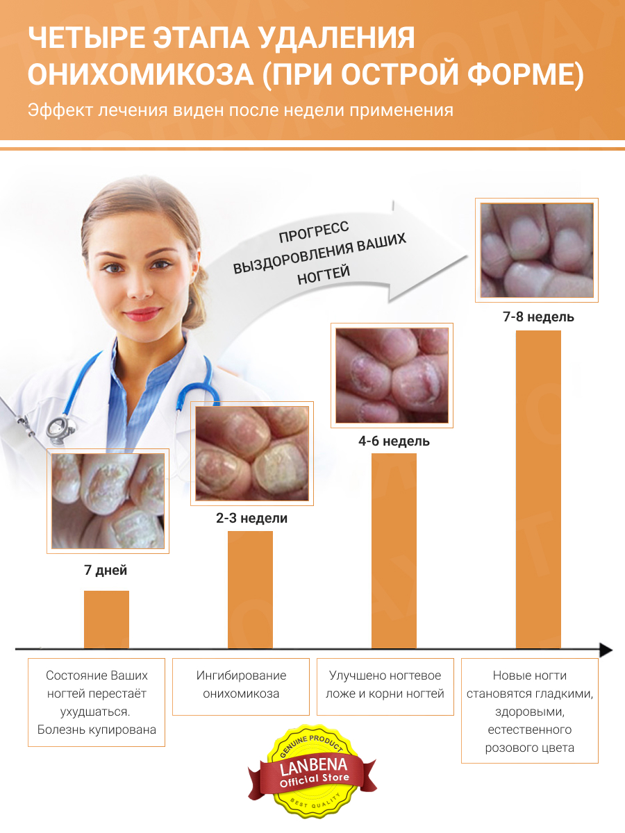 Бесцветный гель LANBENA Средство для ногтей от грибка на ногах - фото 4