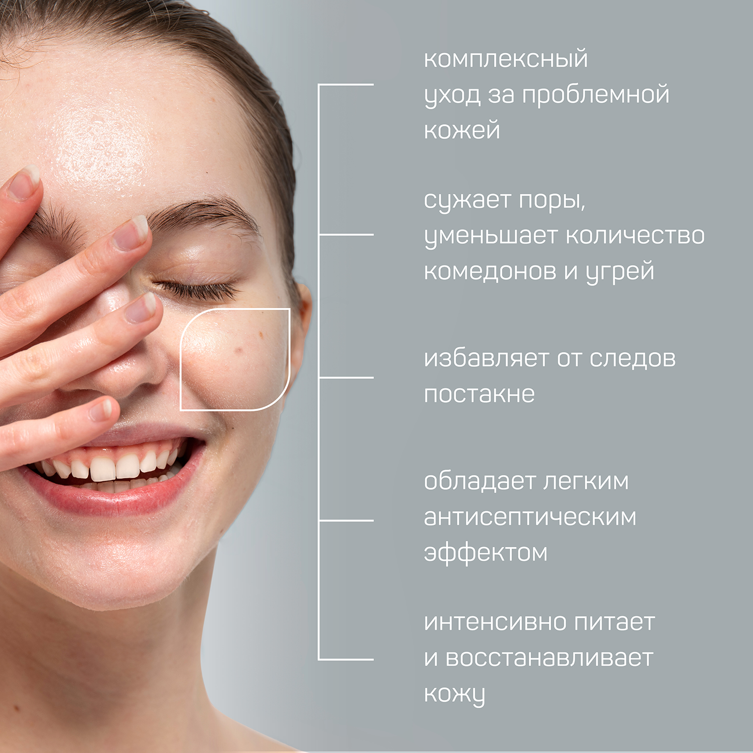 Сыворотка для лица Green Mama нормализующая Anti acne для проблемной кожи 30 мл - фото 3