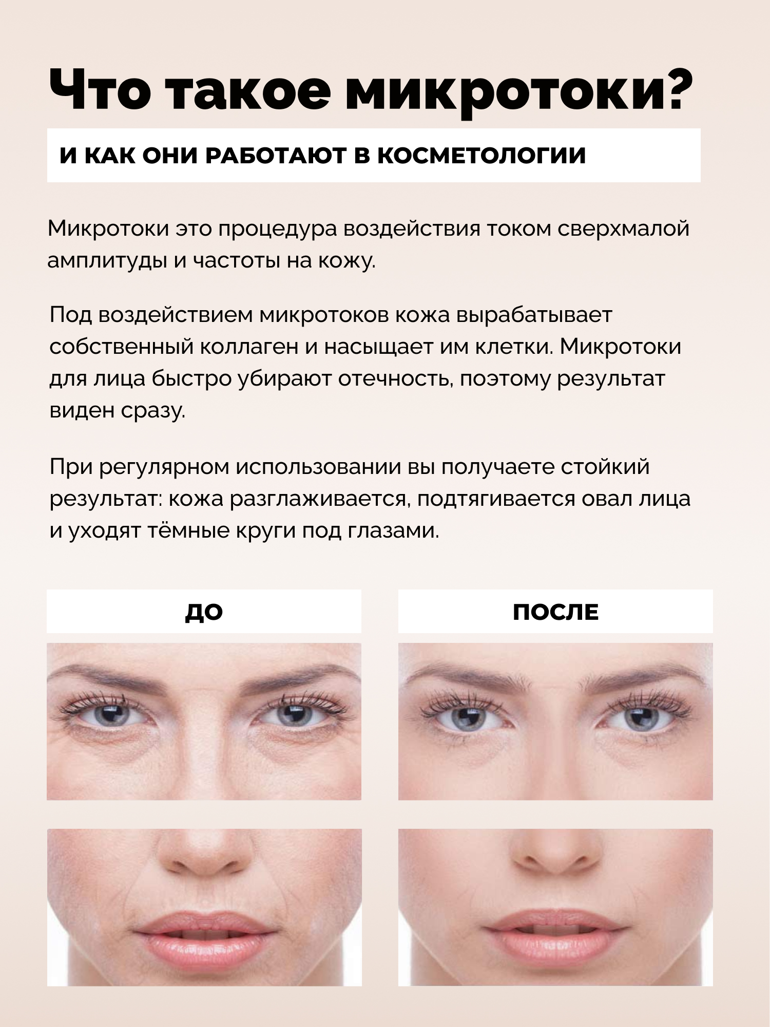 Микротоковый массажер для лица GESS Sfera купить по цене 4806 ₽ в интернет-магаз