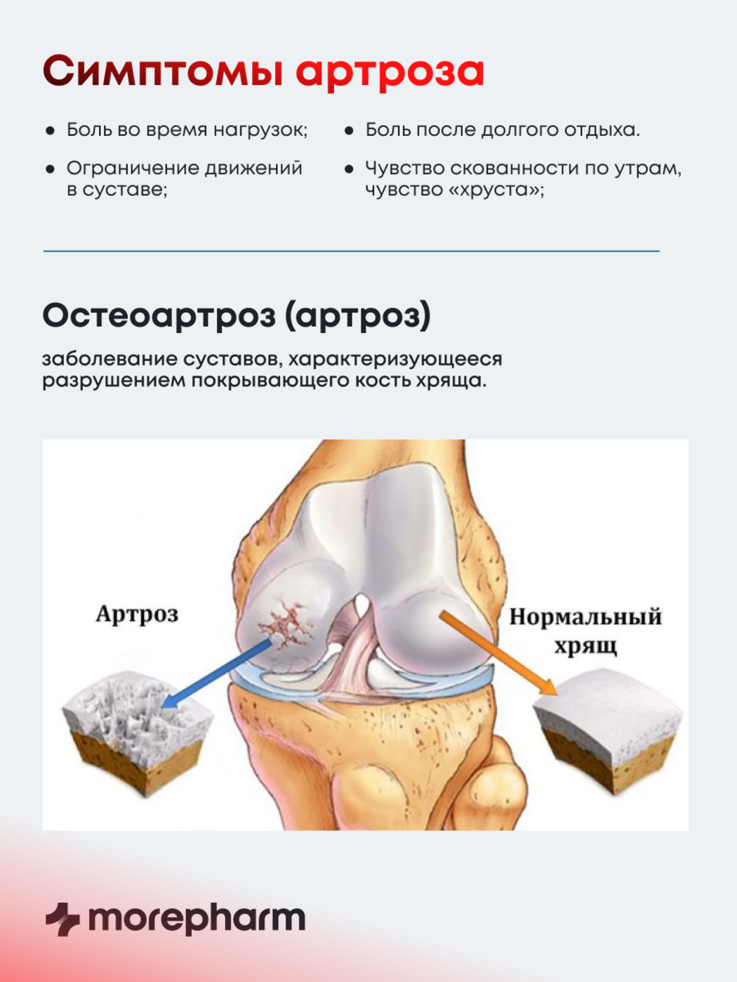 БАД morepharm Глюкозамин хондроитин с Mсм добавка для суставов и связок - фото 12