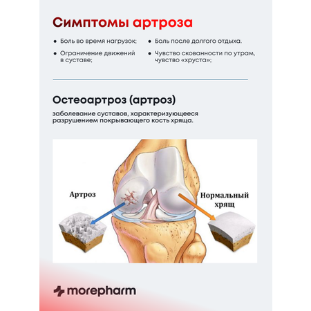 БАД morepharm Глюкозамин хондроитин с MCM добавка для суставов и связок