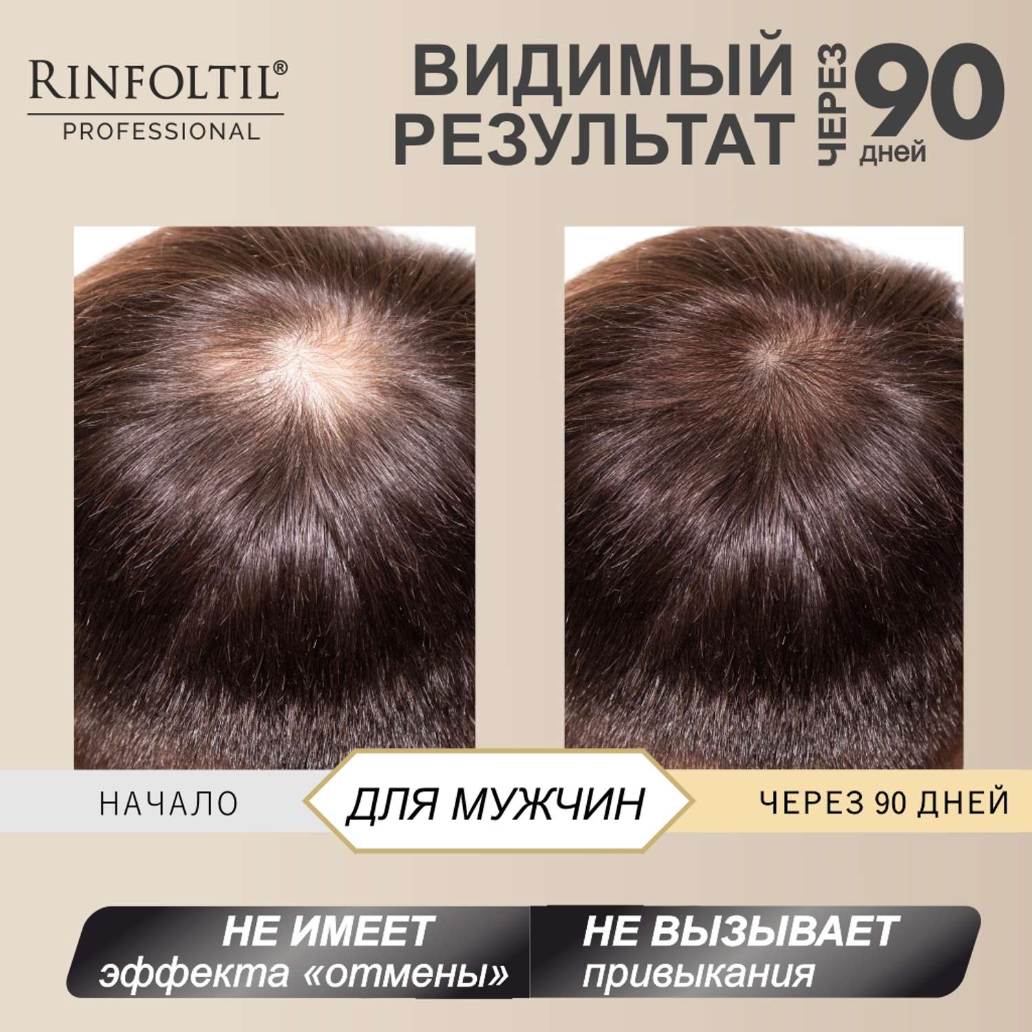 Лосьон Rinfoltil СЕРЕНОА лосьон для мужчин для улучшения качества волос и ухода за кожей головы - фото 7