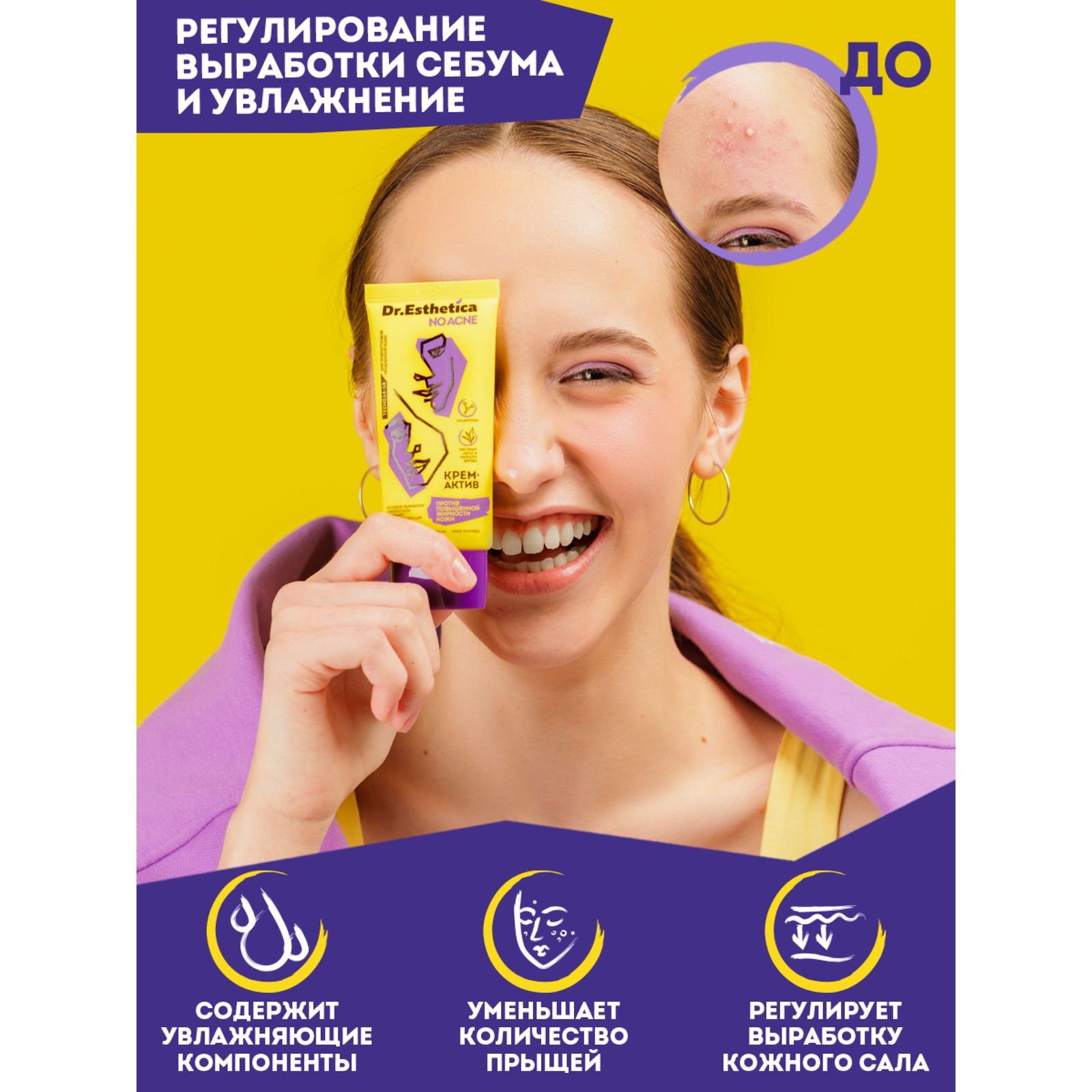 Крем-актив Dr. Esthetica против прыщей 50 мл - фото 5