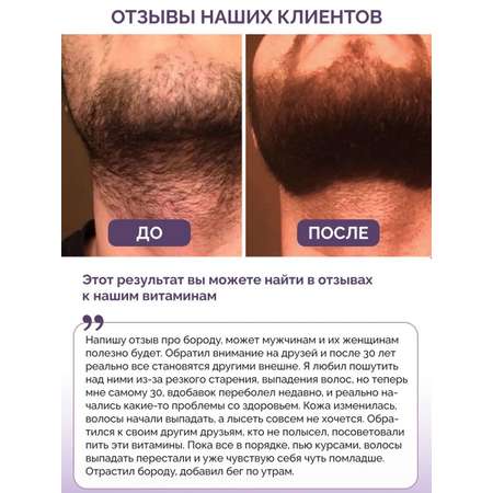 Витамины для волос кожи ногтей BIOTTE витаминно-минеральный комплекс БАД 120 капсул