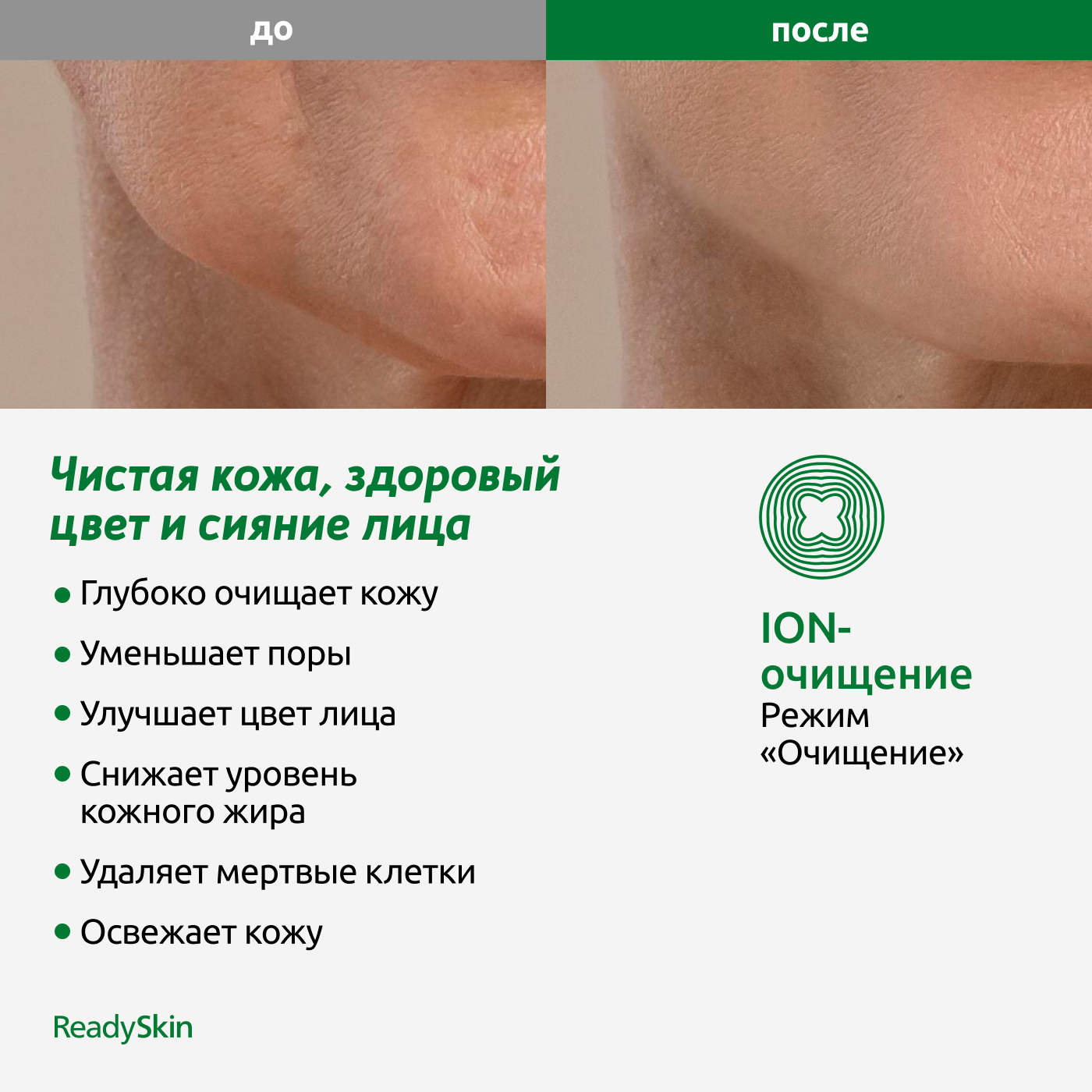 Прибор ReadySkin Octa для очищения и омоложения кожи - фото 5