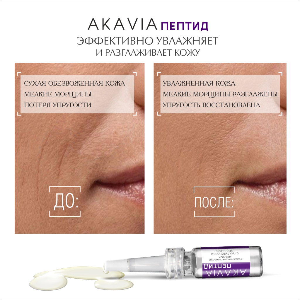 Сыворотка АКАВИЯ Peptide увлажняющая для лица с гиалуроновой кислотой - фото 6