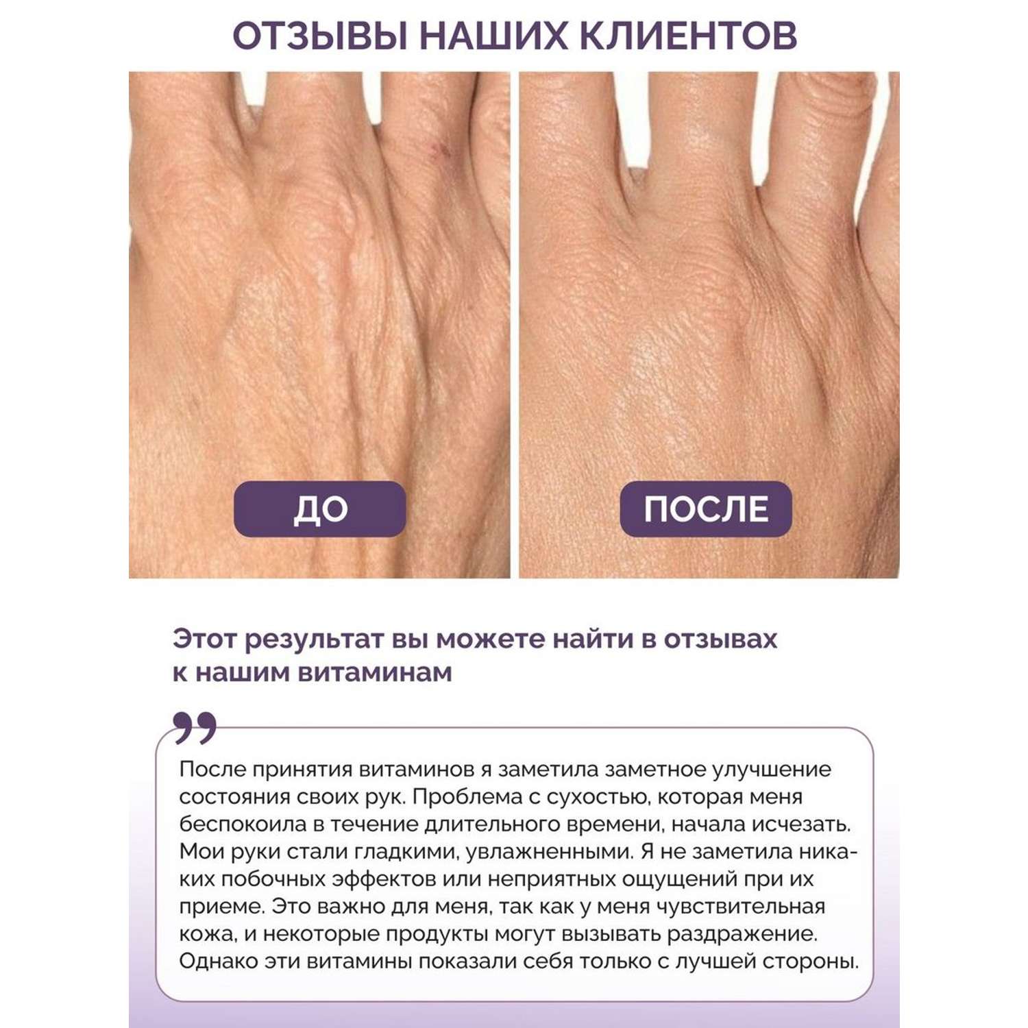 Витамины для волос кожи ногтей BIOTTE hair nails skin витаминно-минеральный комплекс БАД 60 капсул - фото 5