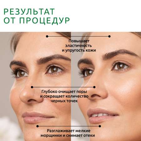 Ультразвуковая чистка ReadySkin Diva