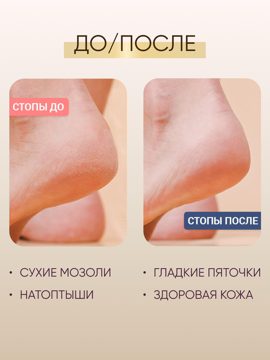 Пилка для пяток OLZORI VirGo Foot A - фото 5