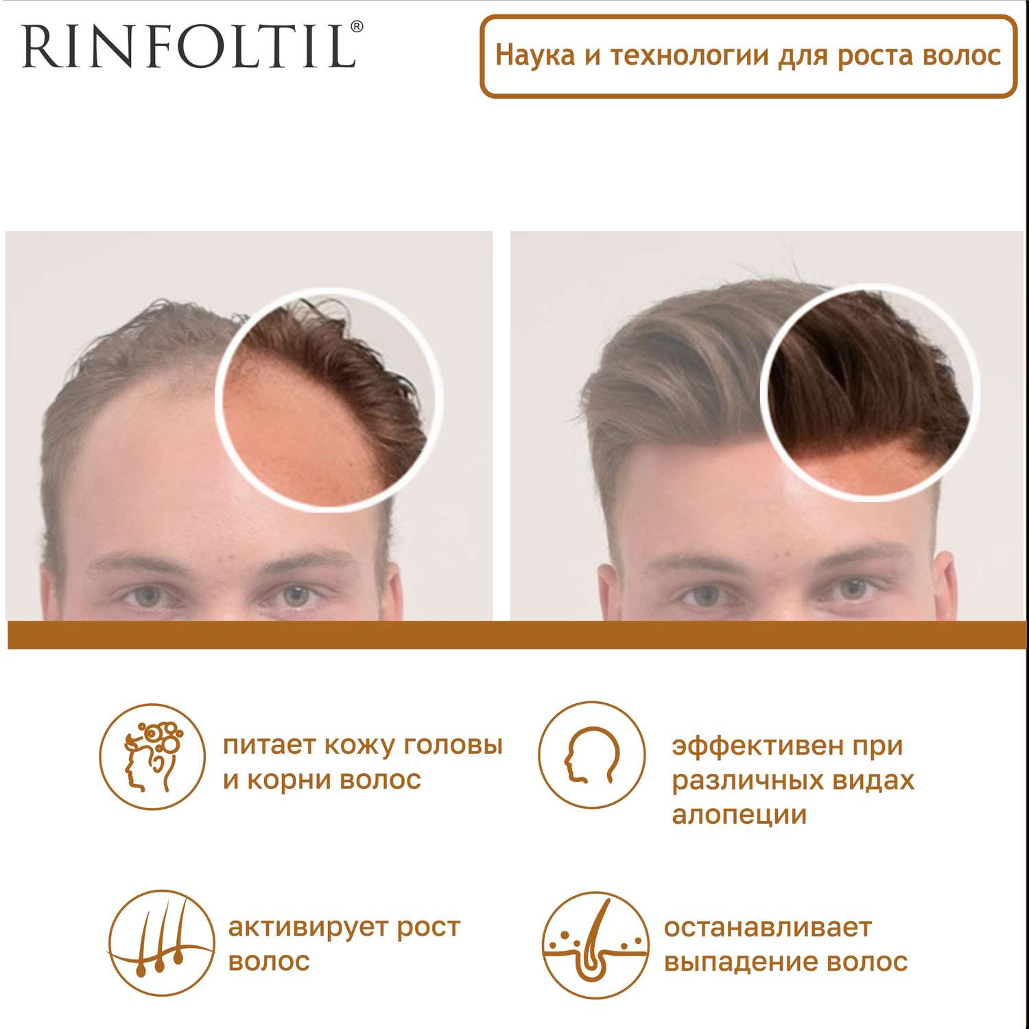 Сыворотка Rinfoltil Липосомальная против выпадения волос. Для предотвращения облысения у мужчин - фото 4