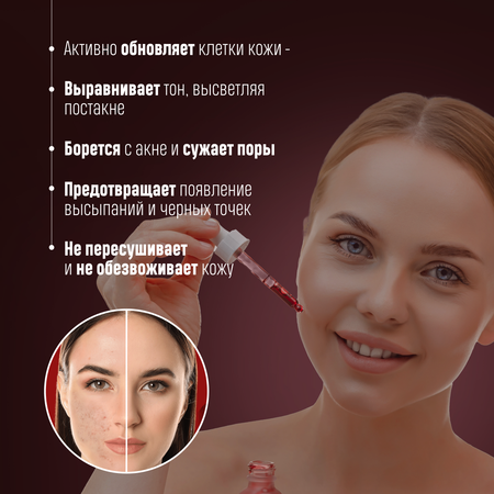 Пилинг для лица с кислотами Red Blood Peeling Skinphoria Обновляющий