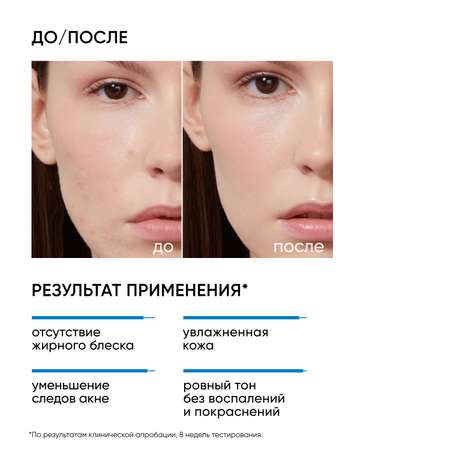 Крем для лица ICON SKIN Увлажняющий склонной к акне Moist and Heal