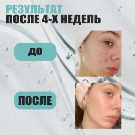 Гель для умывания EDEN Stop Acne против высыпаний 150мл