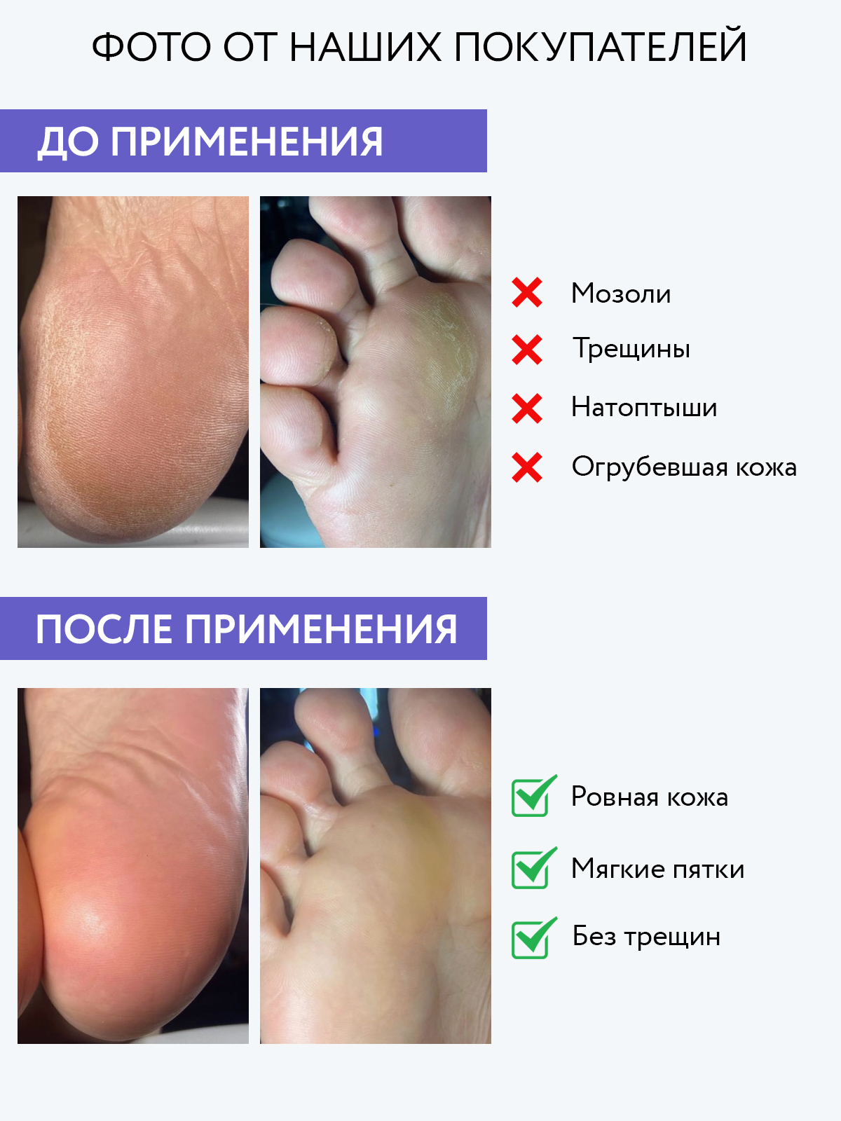 Крем для ног ARAVIA Professional для удаления мозолей и натоптышей Жидкий педикюр Liquid Pedicure 150 мл - фото 6