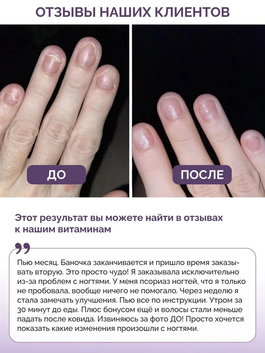 Витамины для волос кожи ногтей BIOTTE hair nails skin витаминно-минеральный комплекс БАД 60 капсул - фото 4
