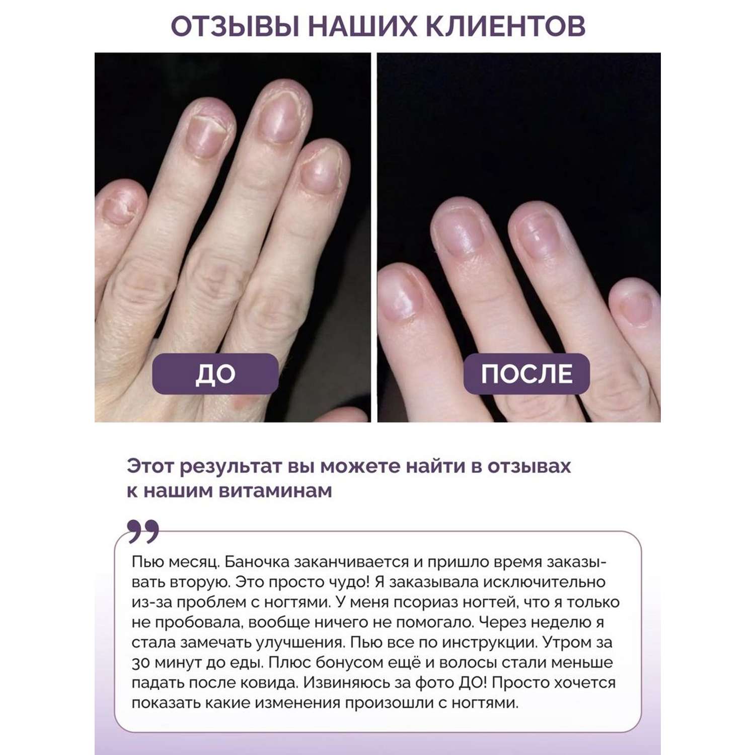 Витамины для волос кожи ногтей BIOTTE hair nails skin витаминно-минеральный комплекс БАД 60 капсул - фото 4
