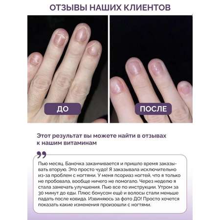 Витамины для волос кожи ногтей BIOTTE hair nails skin витаминно-минеральный комплекс БАД 60 капсул