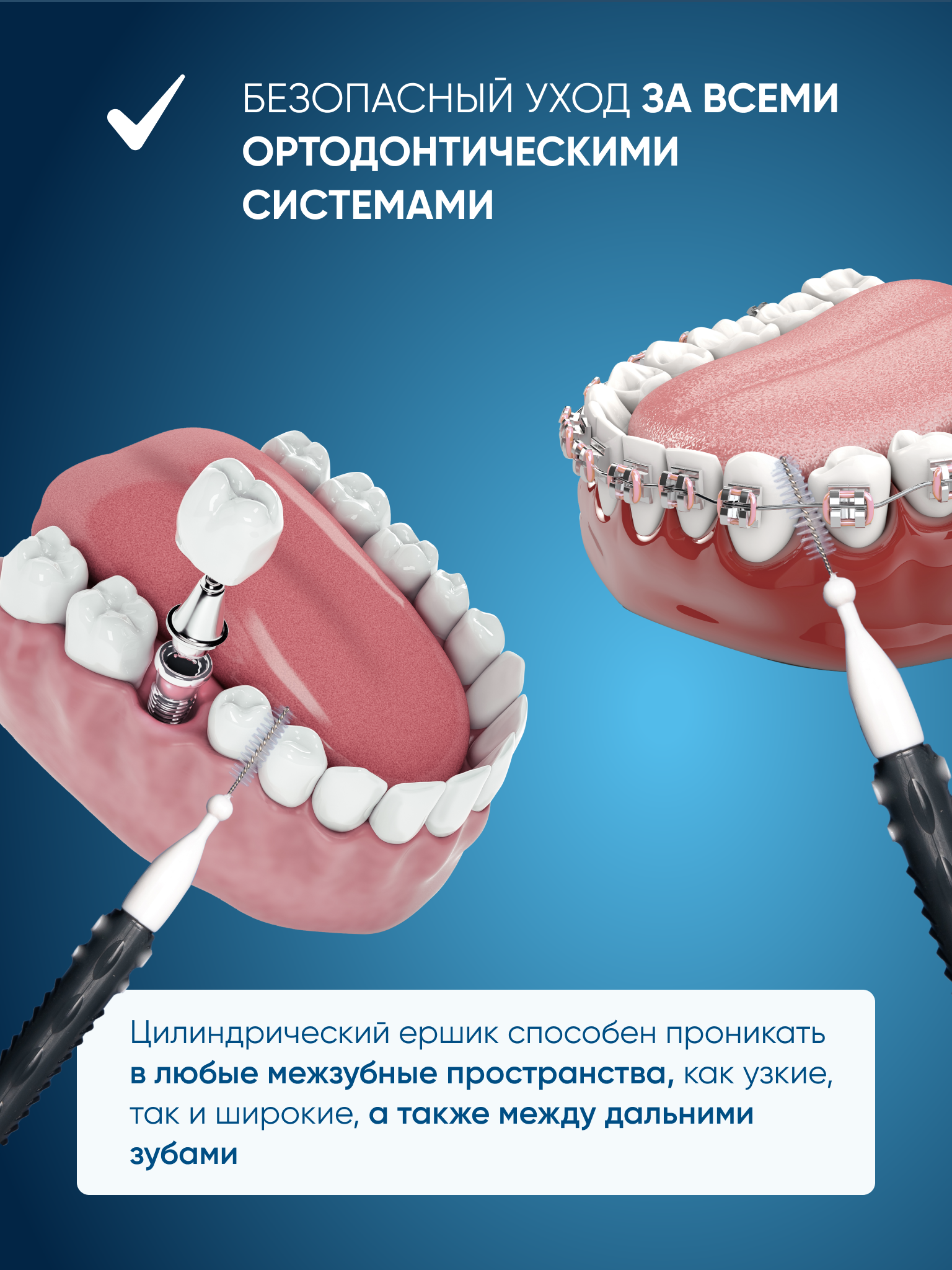 Межзубные ёршики PECHAM Interdental РС - 601 - фото 4