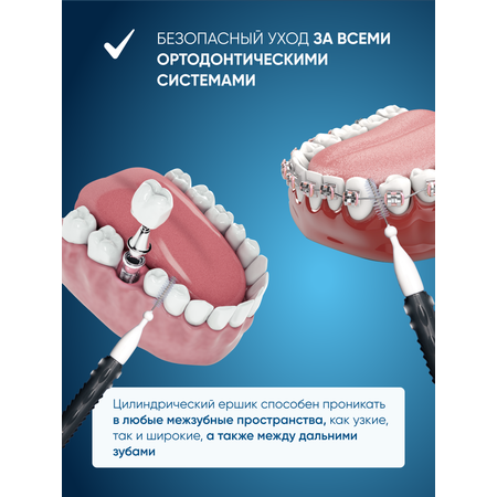 Межзубные ёршики PECHAM Interdental РС - 601