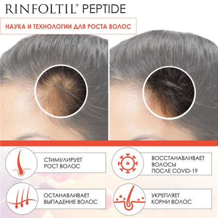 Сыворотка Rinfoltil ПЕПТИД Липосомальная против выпадения волос