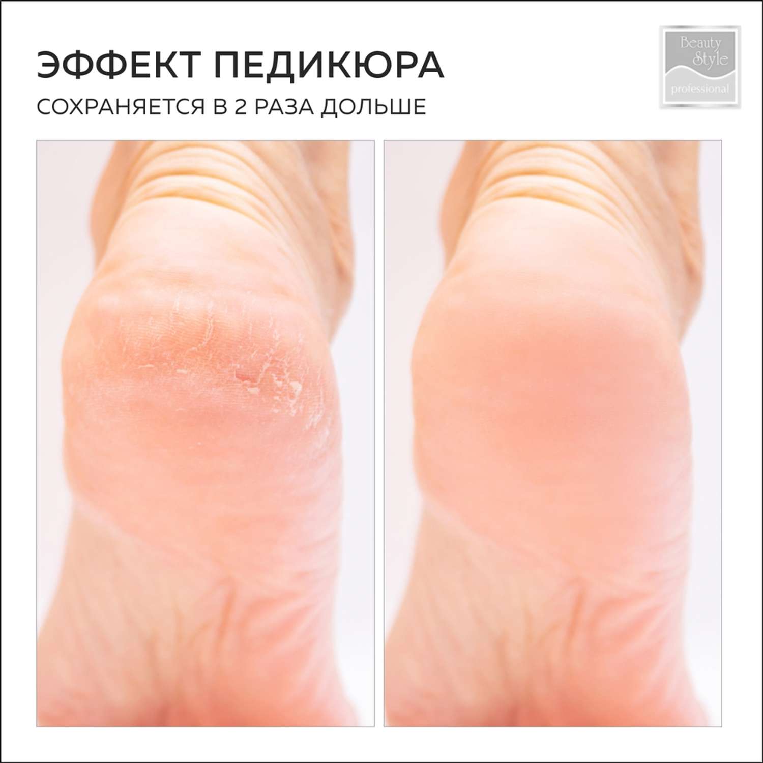 Смягчающий крем для ног Beauty Style и тела Urea 20% и кислотами молочной и гликолевой 500 мл - фото 5