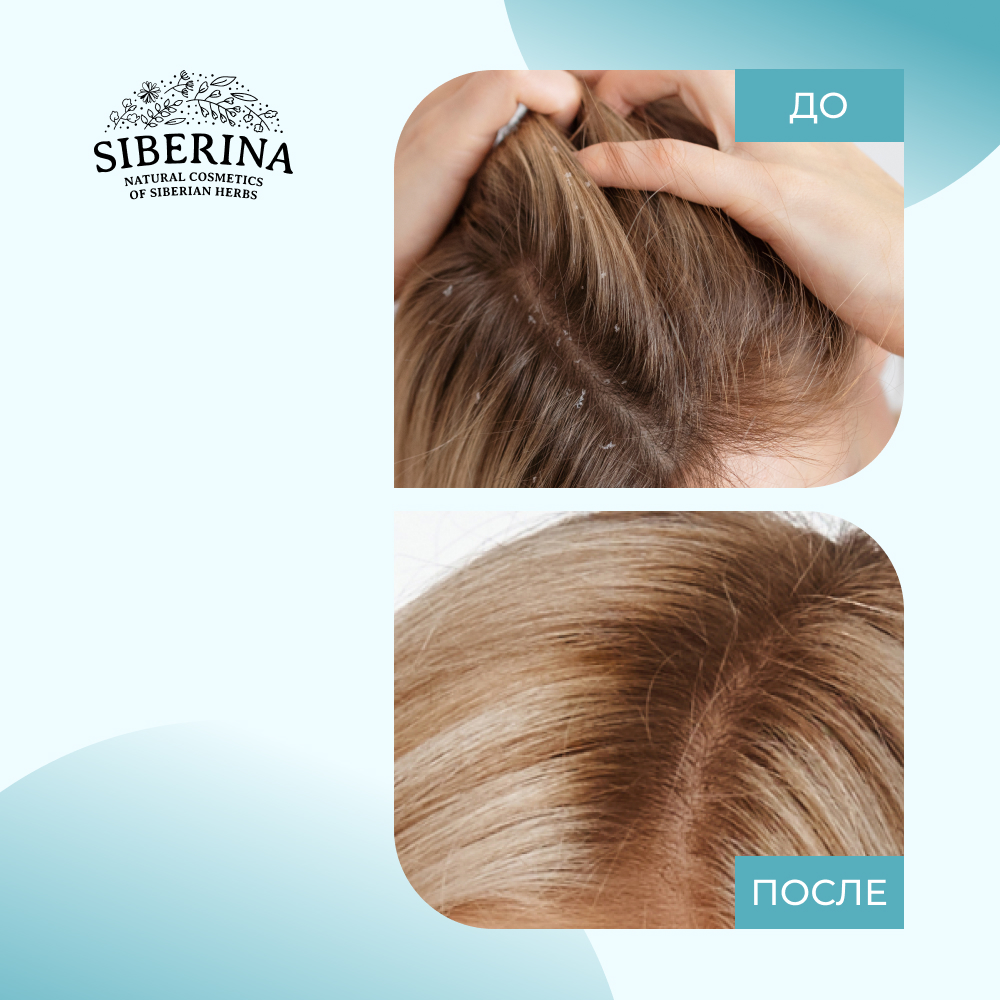 Кондиционер Siberina натуральный «Против перхоти и выпадения волос» с витаминами 200 мл - фото 6
