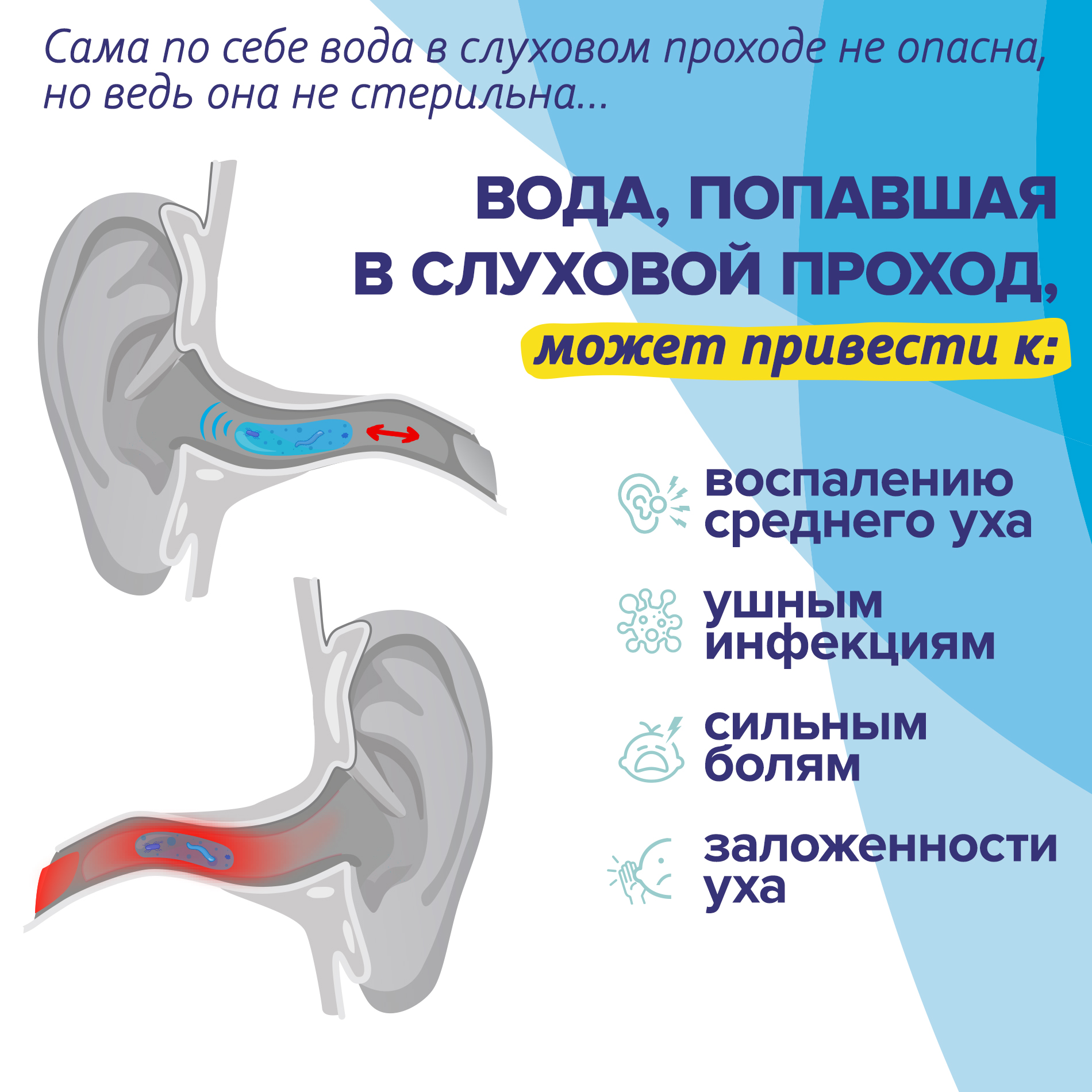 Спрей ИАР ПРО защита ушей от воды и инфекций - фото 3