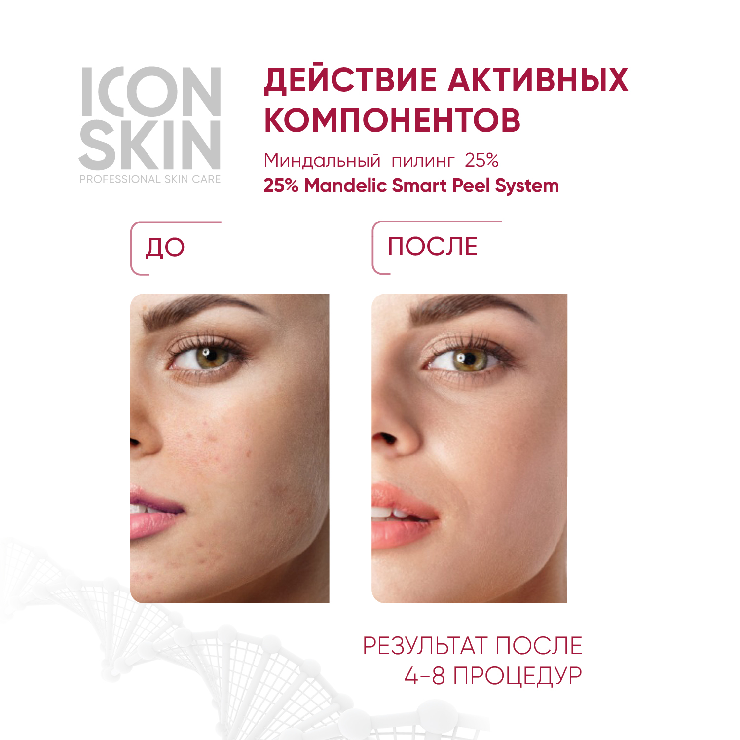 Пилинг ICON SKIN миндальный 25% 30 мл