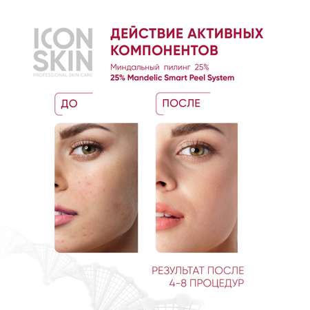 Пилинг ICON SKIN миндальный 25% 30 мл