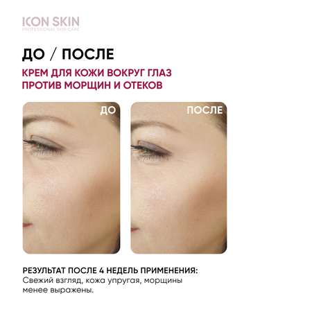 Крем для кожи вокруг глаз ICON SKIN Youth Elixir