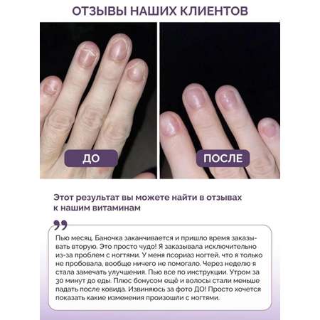 Витамины для волос кожи ногтей BIOTTE hair nails skin витаминно-минеральный комплекс БАД 180 капсул
