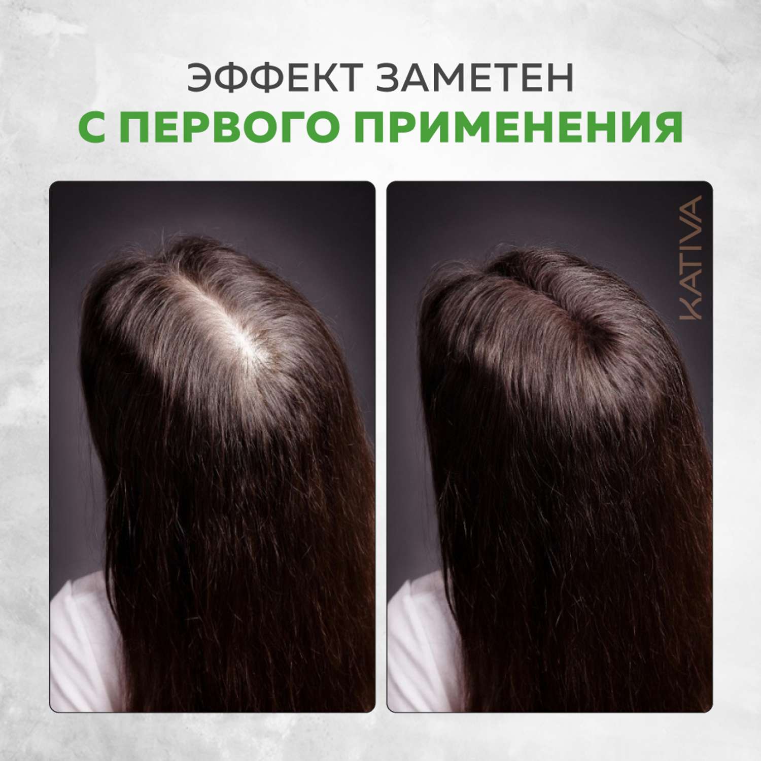 Концентрат Kativa против выпадения волос в ампулах Biotina 12 шт по 4 мл - фото 6
