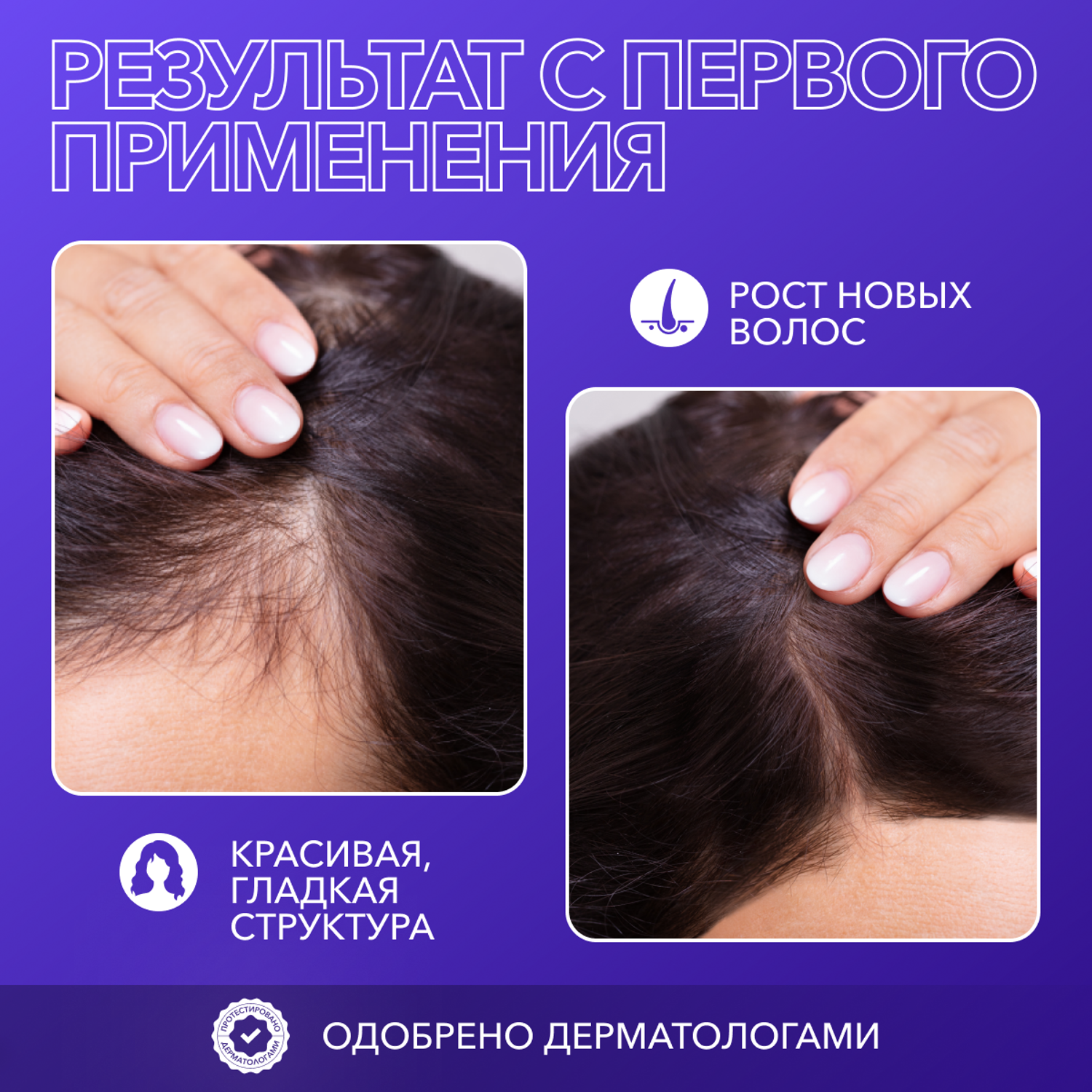 Витамины для волос Glatte 60 капсул - фото 2