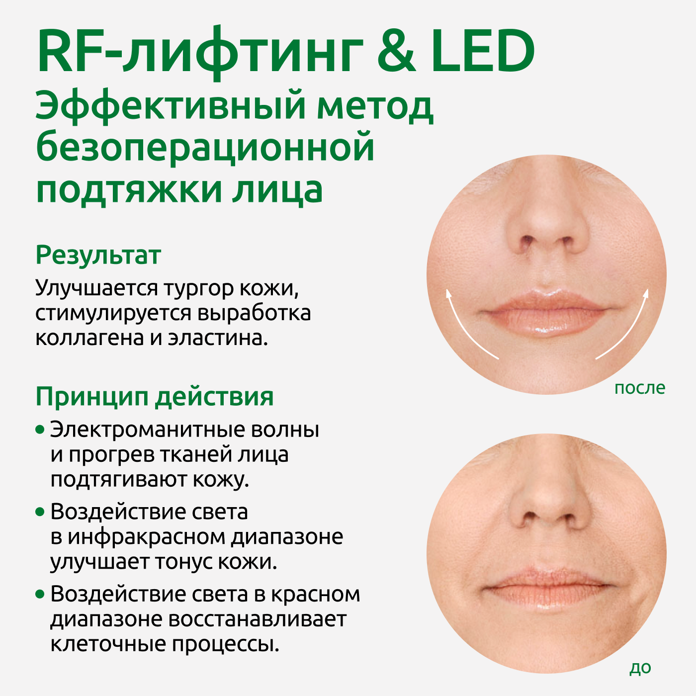 Аппарат для омоложения ReadySkin Eva - фото 5