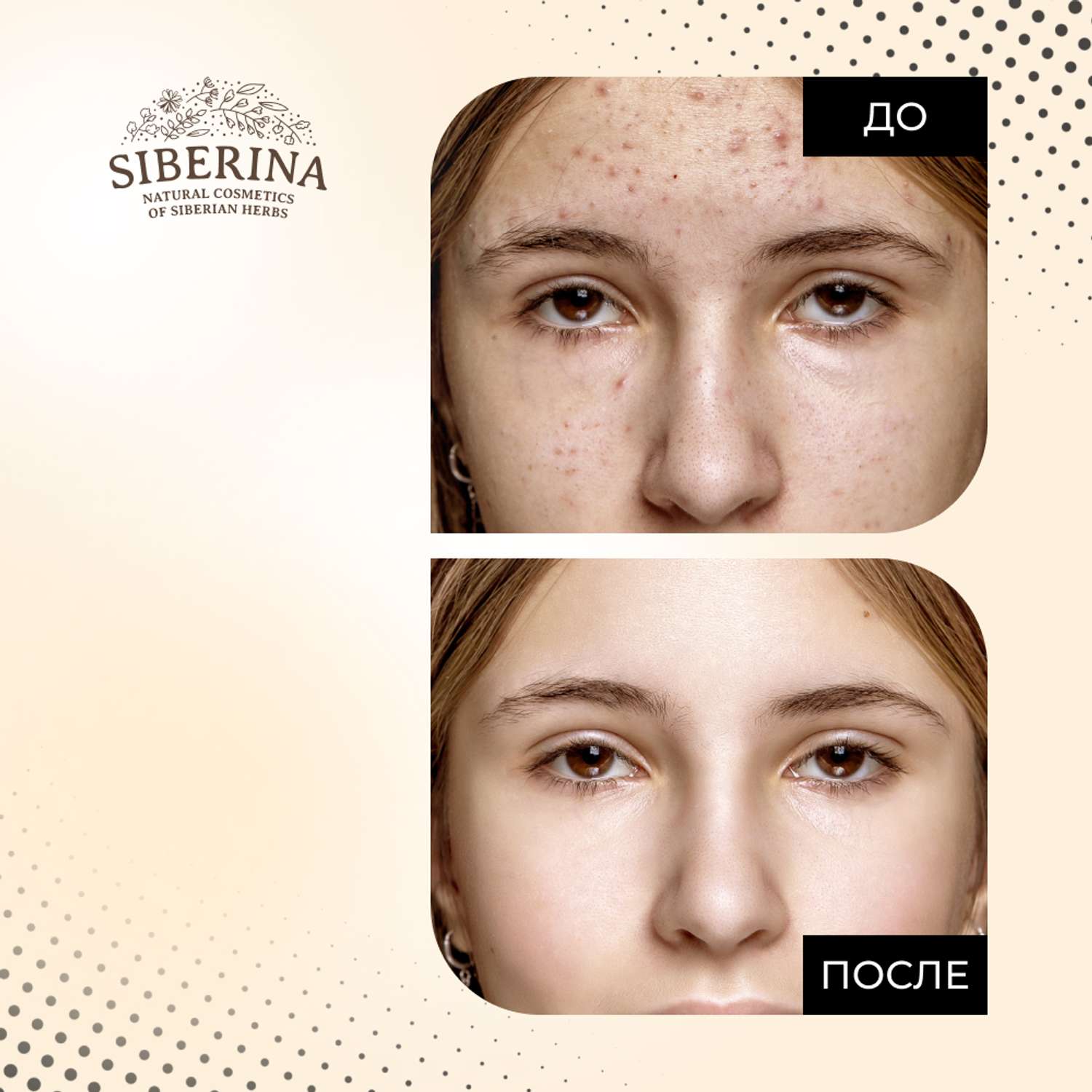Сыворотка для лица Siberina натуральная для жирной и проблемной кожи c AHA-кислотами 30 мл - фото 7