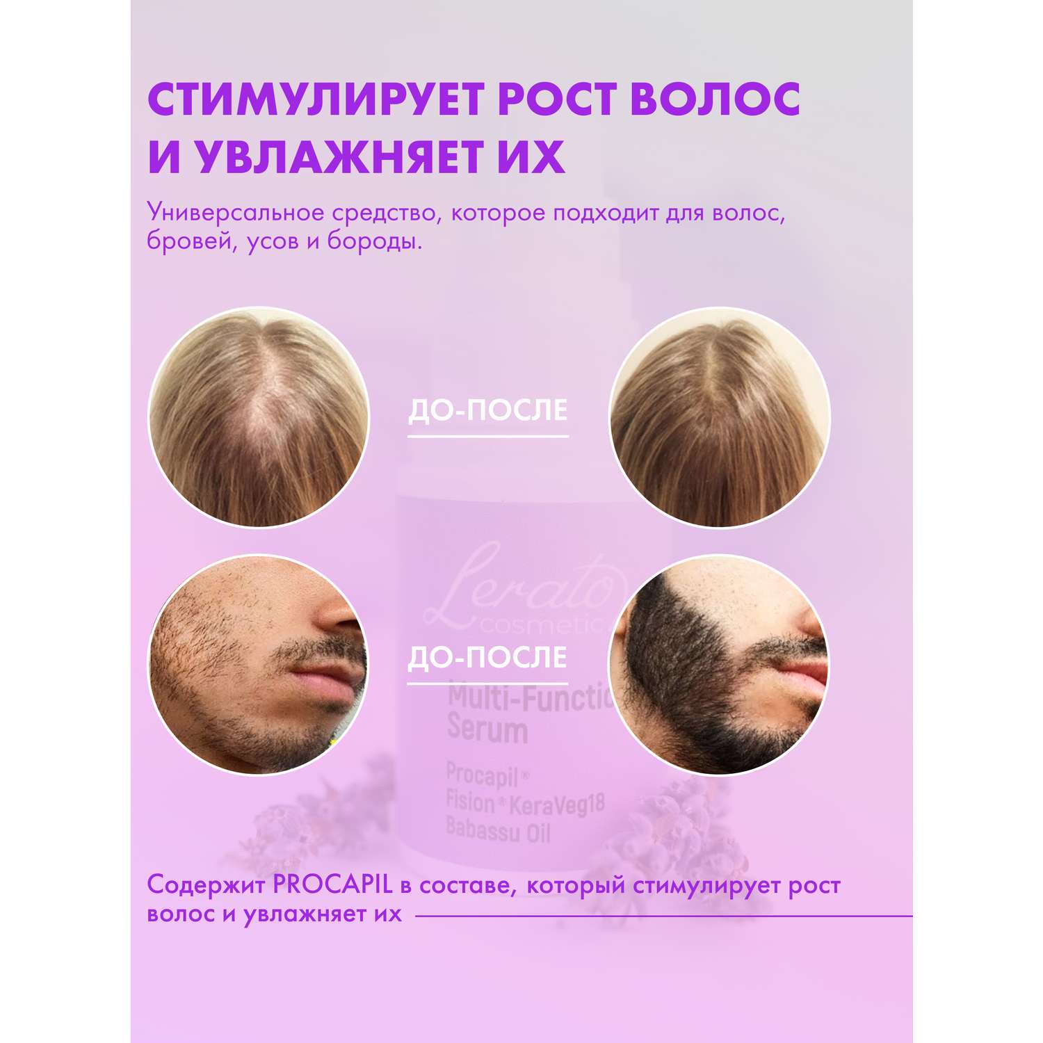 Сыворотка Lerato Cosmetic для стимулирования роста волос Multi Function Serum 30 мл - фото 2