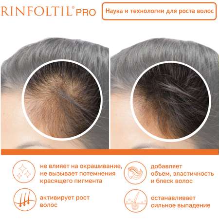 Сыворотка Rinfoltil PRO Нанолипосомальная против выпадения волос для женщин и мужчин